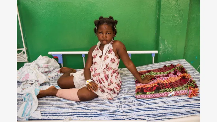  La pequeña Gulneuis Maicha, de 6 años, es atendida en un pasillo del Hospital General, este lunes en Les Cayes (Haití). EFE/Orlando Barría